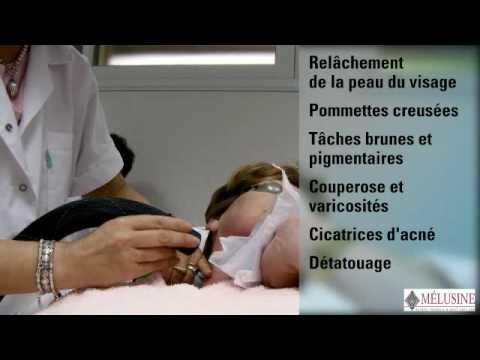 Centre Anti-age de La Roche-Posay - Station Thermale, France